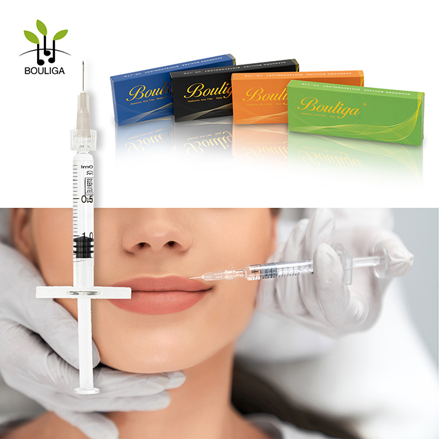 Volumiserende hyaluronzuur opvullende lipfillers