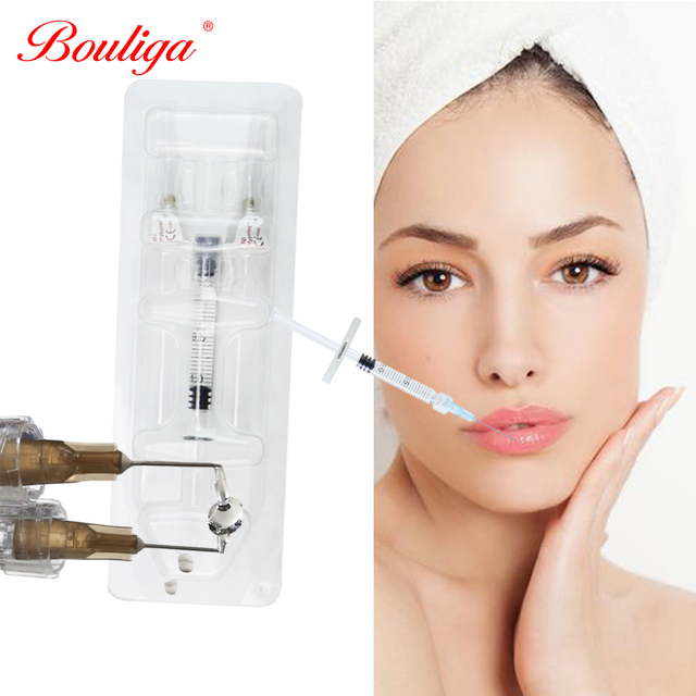 Deep Lip Shaping Dermal Filler injecteerbare natriumhyaluronaatgel