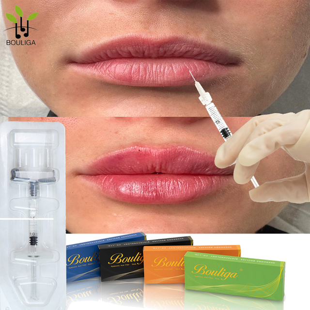 Prachtige lippenvuller van Bouliga 1 ml 2 ml 5 ml 10 ml