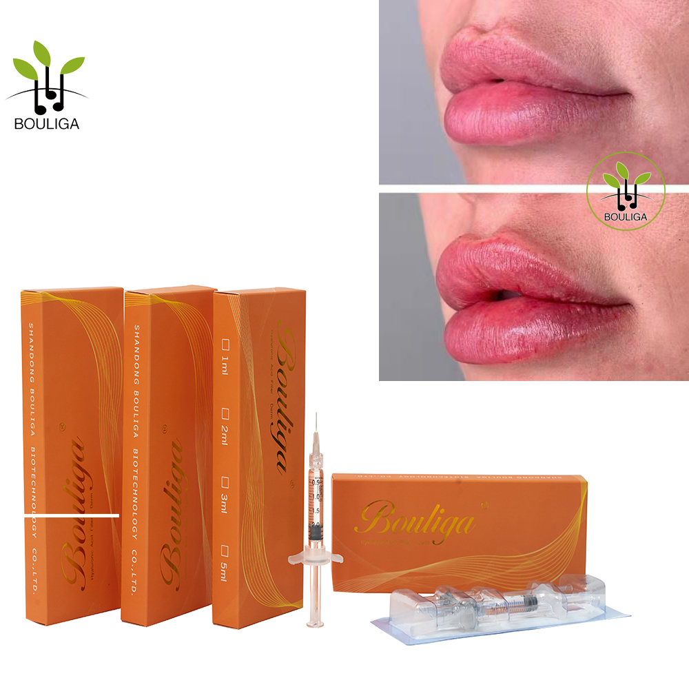 Prachtige lippenvuller van Bouliga 1 ml 2 ml 5 ml 10 ml