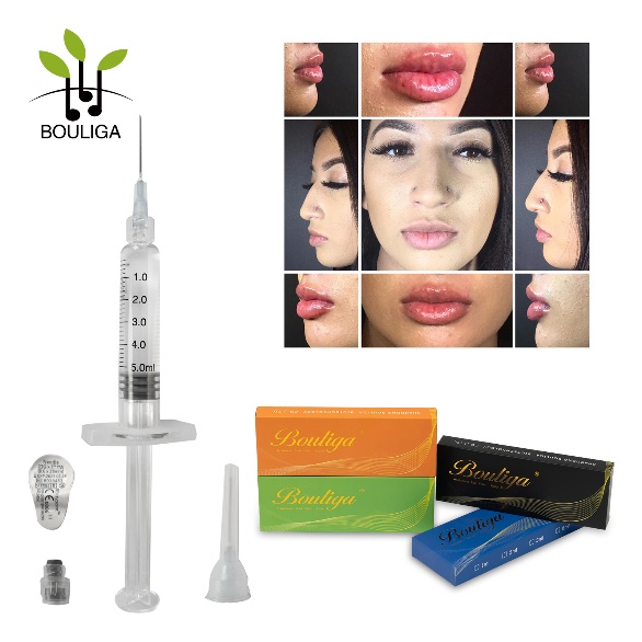 Injecteerbaar 1 ml 2 ml 3 ml 5 ml verknoopte hyaluronzuurinjecties Huidvuller / Ha-vuller voor lippen, neus, rimpels, borsten, billen, lichaam, gezicht, nek, plooien