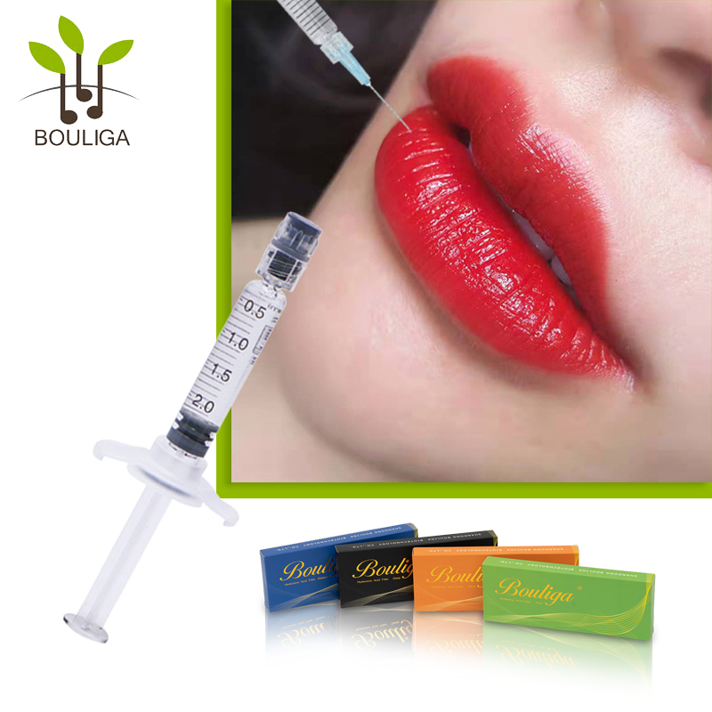 Prachtige lippenvuller van Bouliga 1 ml 2 ml 5 ml 10 ml