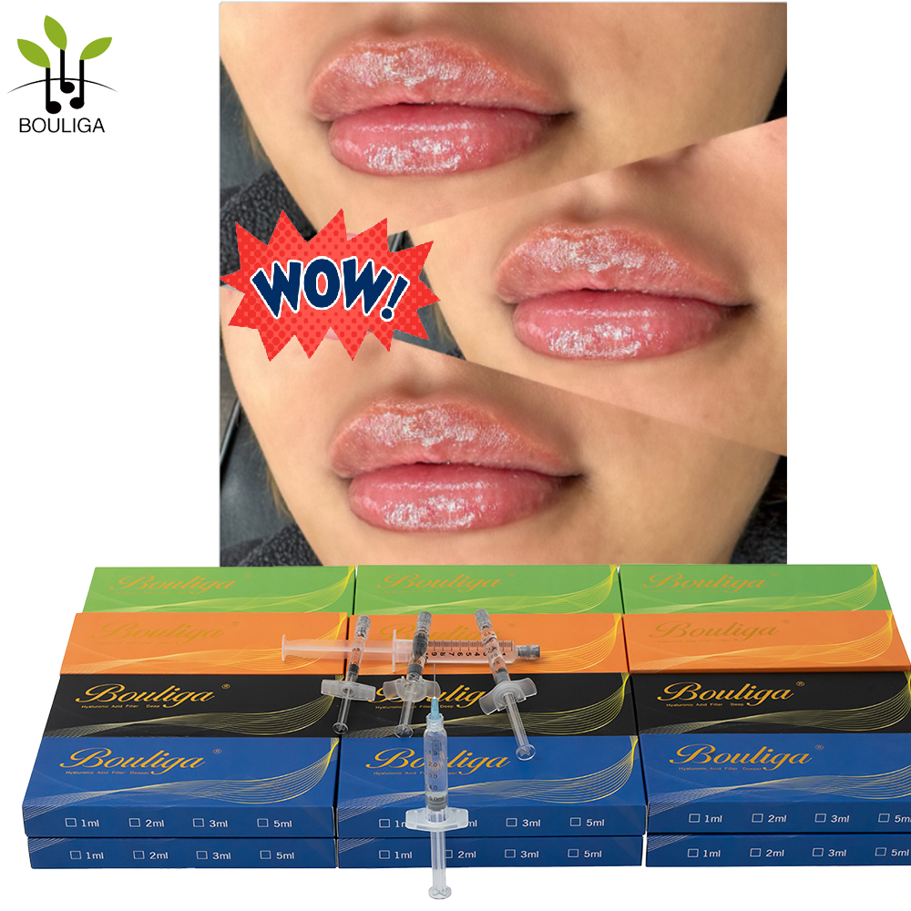 Bouliga 100% hyaluronzuur Geen naalden, niet-invasieve huidvuller voor de lippen